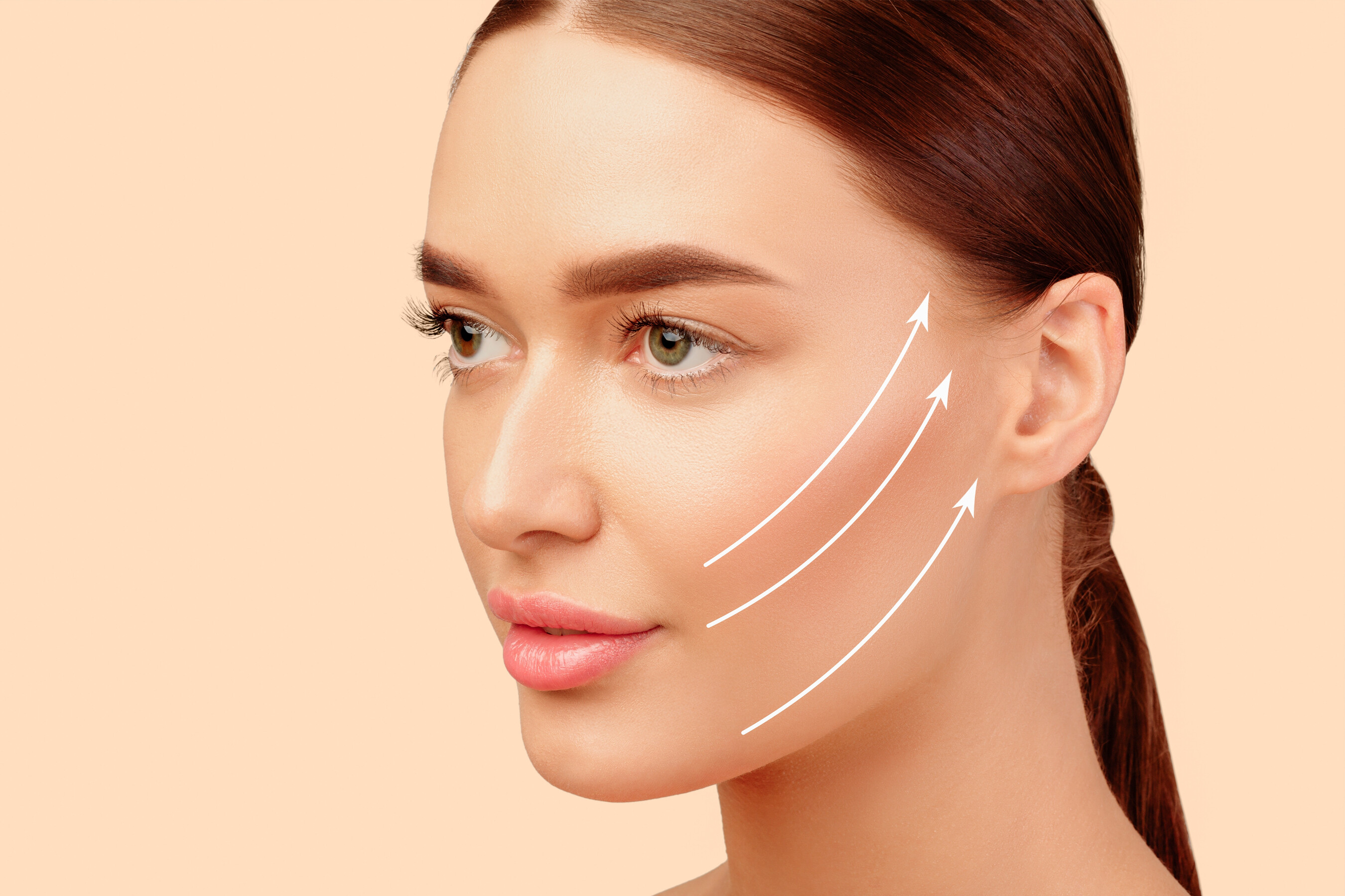 Mini Facelifting Plastische Chirurgie Zürich Dermanence 002