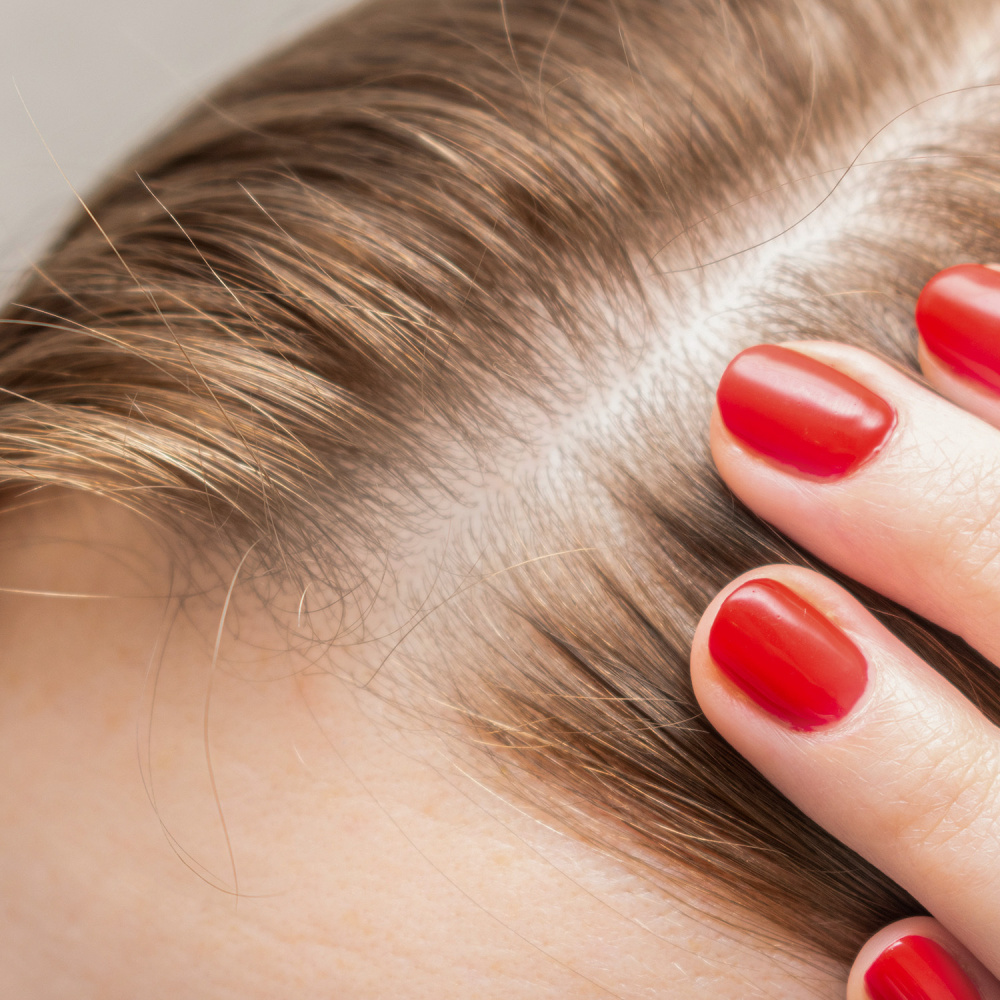 Haarausfall-Behandlung mit PRP