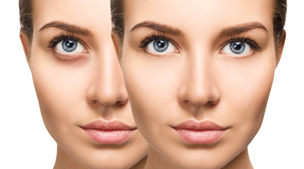 LaseMD Laser Treatment in Zurich – Gentle Skin Rejuvenation and Complexion Refreshment