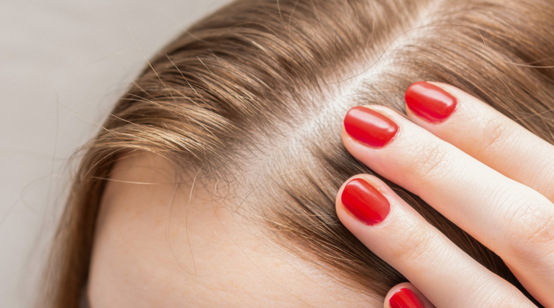 Hair loss treatment with PRP
