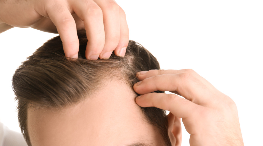 PRP hair loss