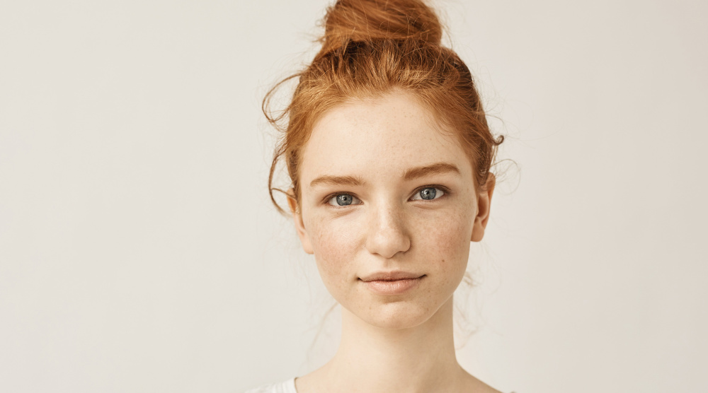 Acne: Causes, Home Remedies, and Treatment Options
