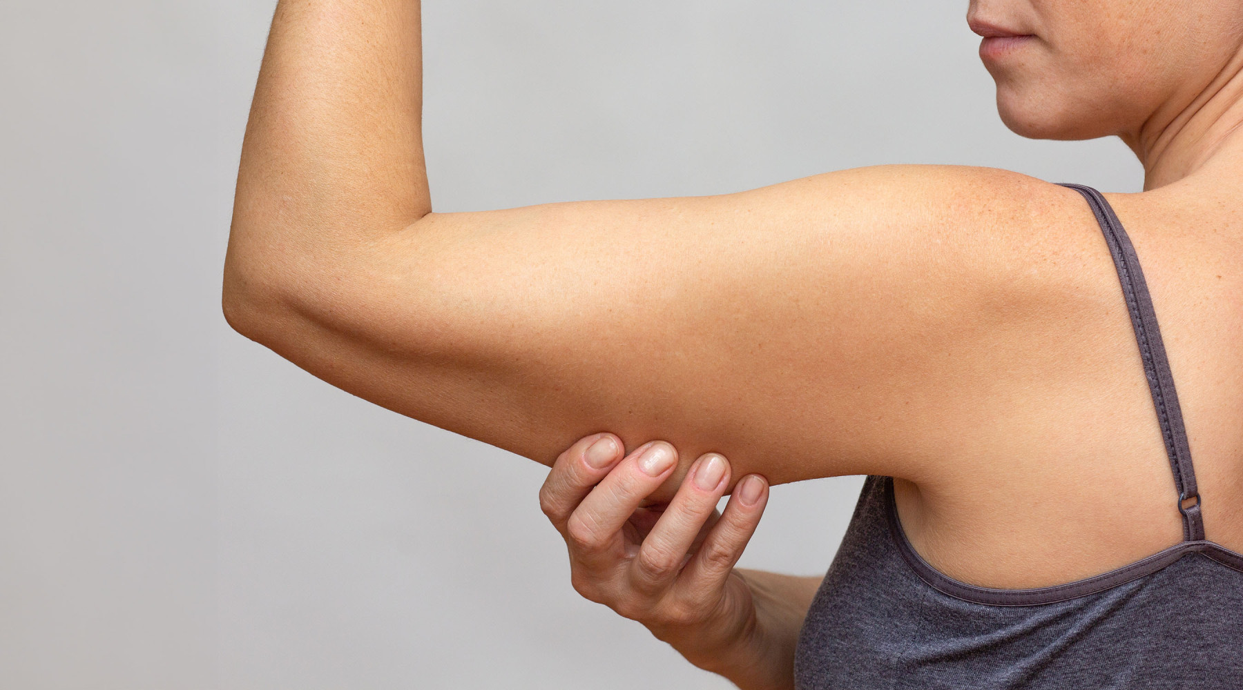 Upper arm lift