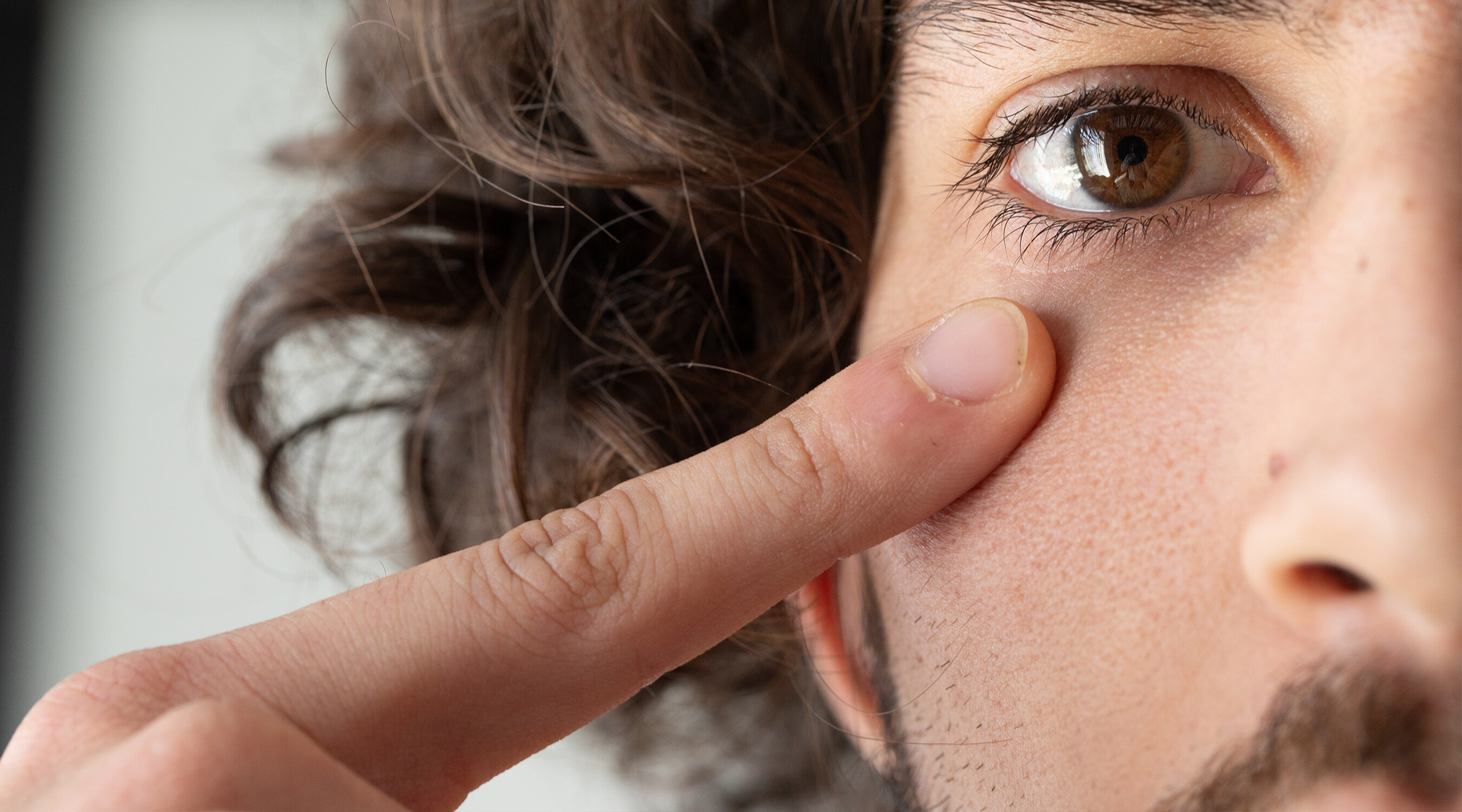 Augenlidstraffung dermanence zuerich 01